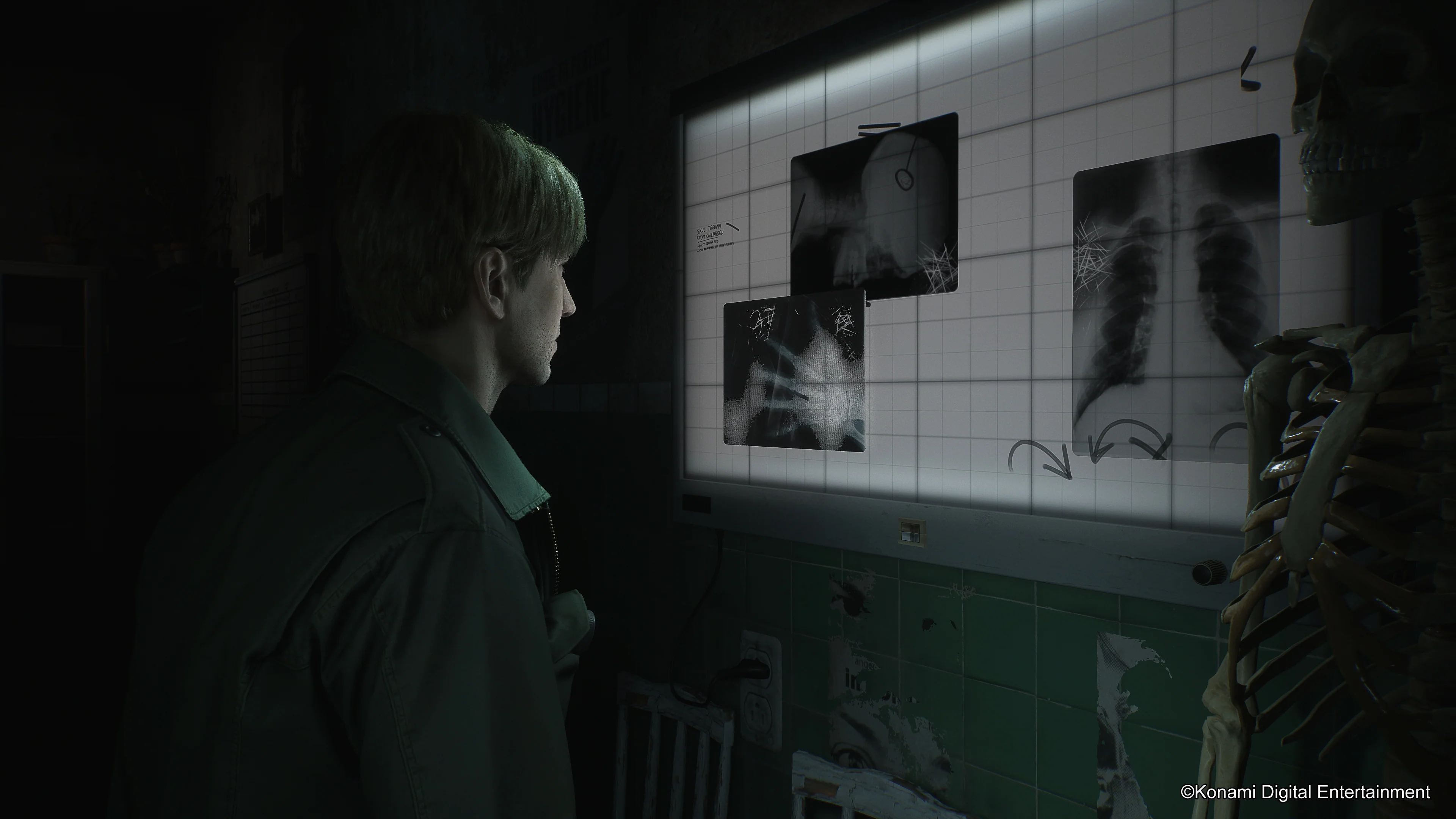 SILENT HILL 2 - Deluxe Edition - Image 6